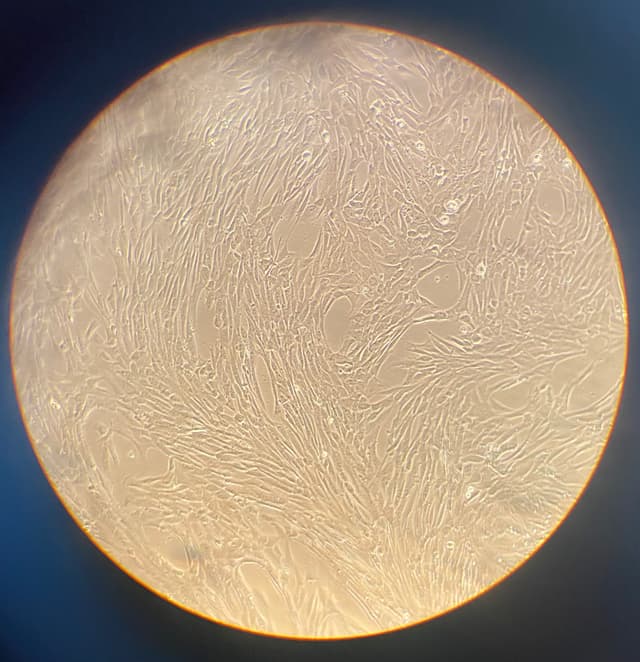 cellule progenitrici derivate da biopsia del muscolo scheletrico