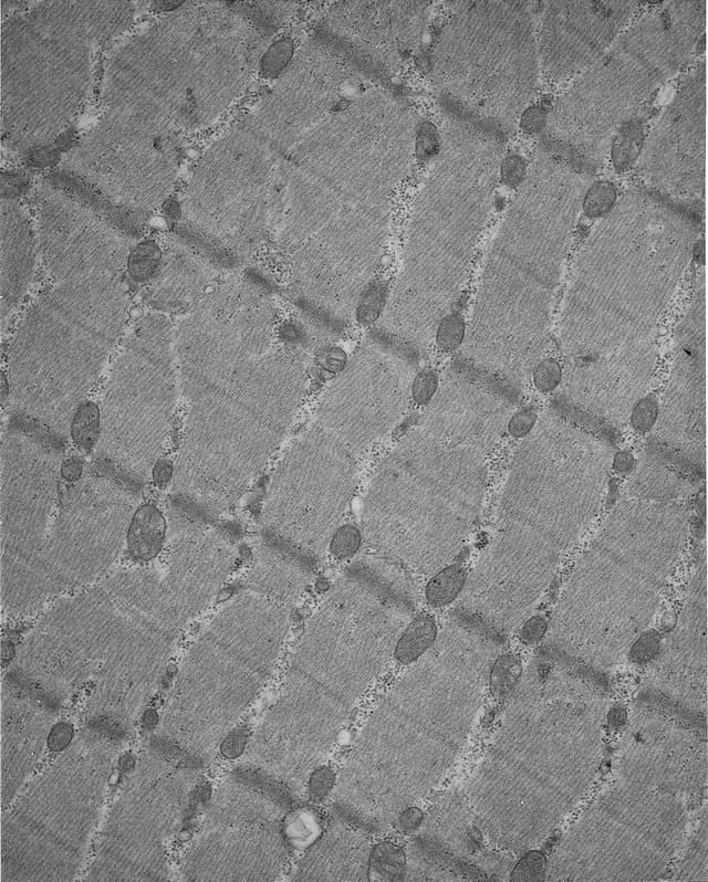 Tessuto muscolare