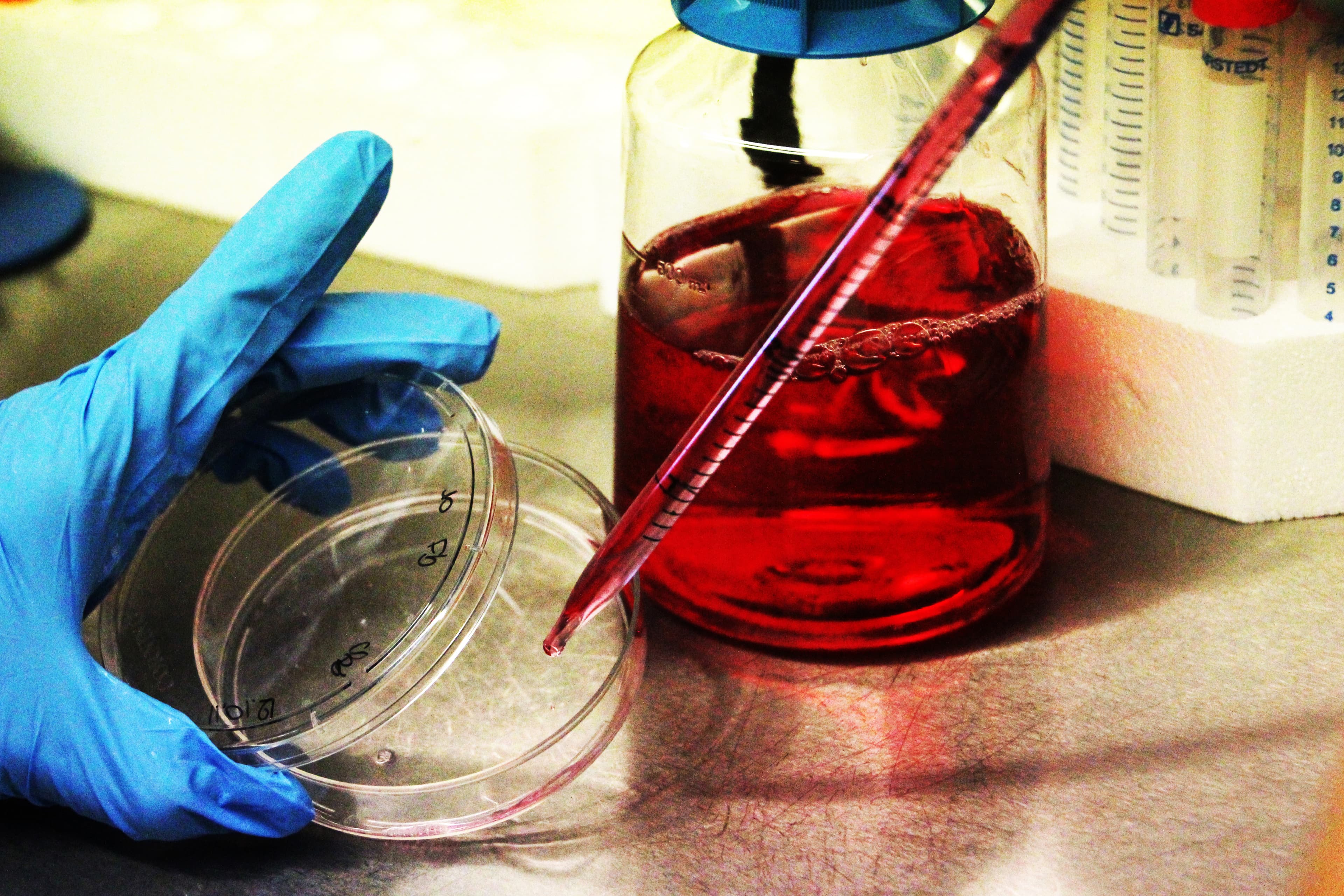 Biobanca Cell line and DNA Bank of Genetic Movement Disorders and Mitochondrial Diseases