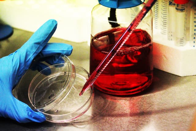 Biobanca Cell line and DNA Bank of Genetic Movement Disorders and Mitochondrial Diseases