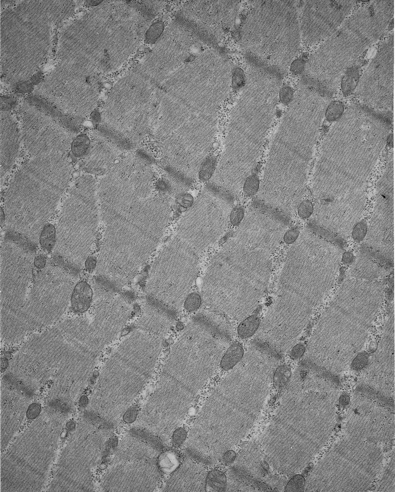 Tessuto muscolare